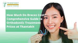 Braces Removal Cost: A Comprehensive Guide